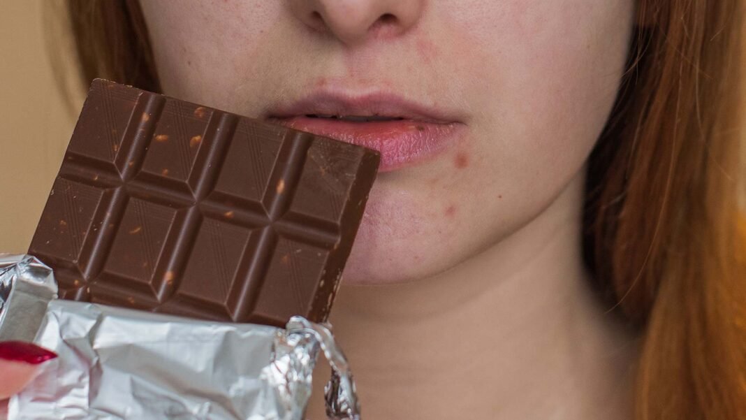 Is It True That Chocolate Causes Skin Problems, Including Pimples